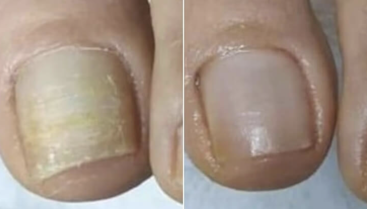 Vorher – Nachher Vergleich (8 Wochen)